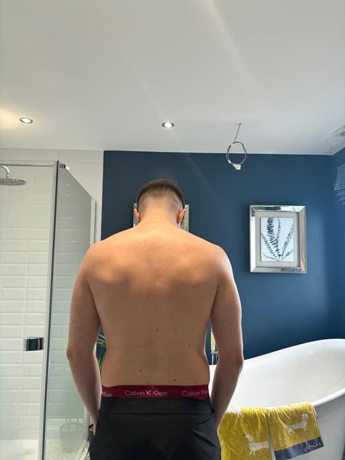 Before transformation