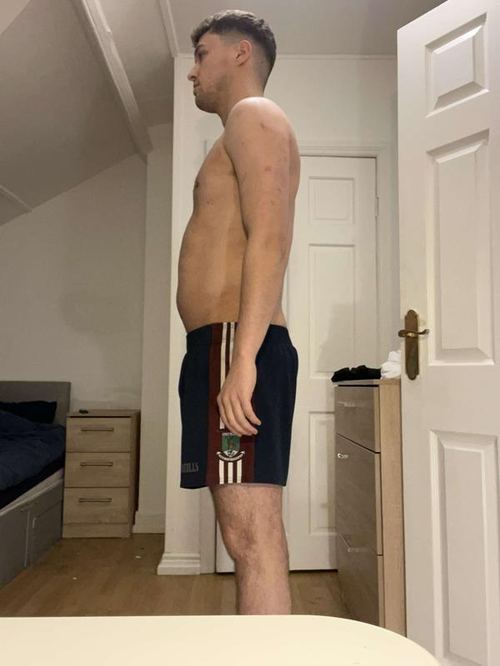 Before transformation